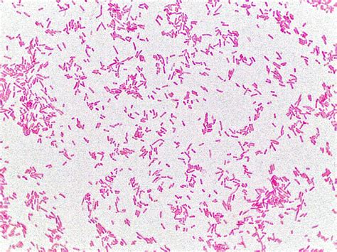 simple stain e coli.